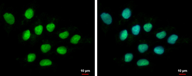 DIS3 Antibody in Immunocytochemistry (ICC/IF)