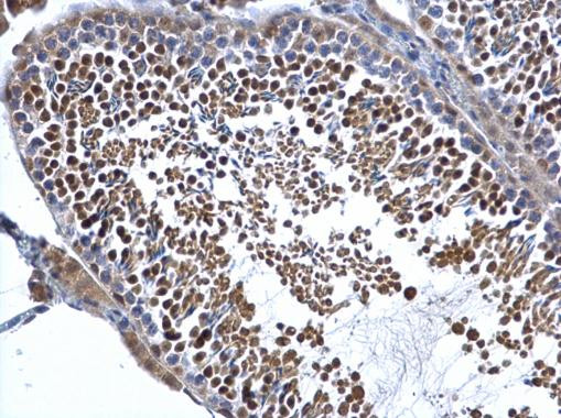 DIS3 Antibody in Immunohistochemistry (Paraffin) (IHC (P))