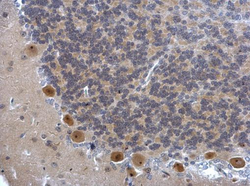 DIS3 Antibody in Immunohistochemistry (Paraffin) (IHC (P))