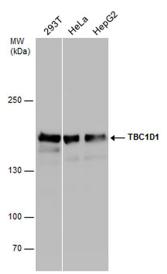 TBC1D1 Antibody in Western Blot (WB)