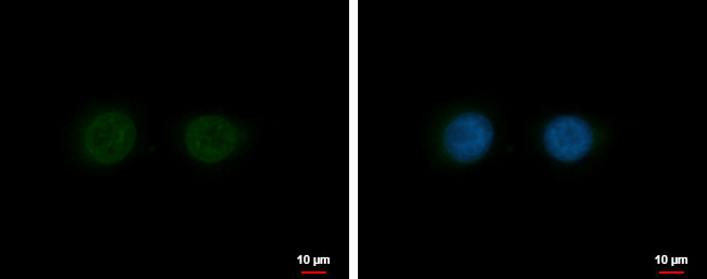 Nesprin 2 Antibody in Immunocytochemistry (ICC/IF)