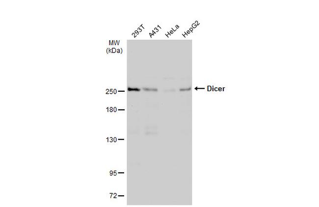 Dicer Antibody in Western Blot (WB)