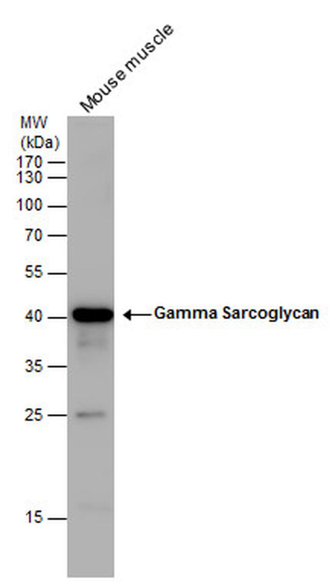 SGCG Antibody in Western Blot (WB)