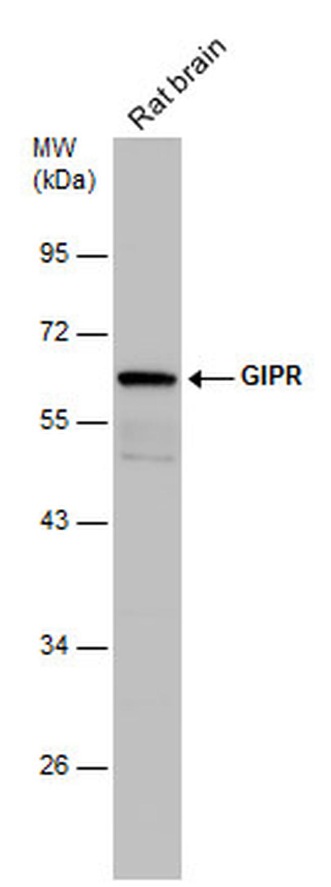 GIPR Antibody in Western Blot (WB)