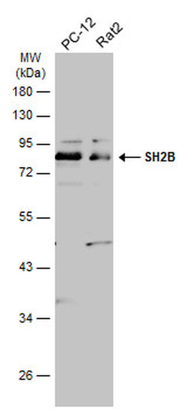 SH2B1 Antibody in Western Blot (WB)