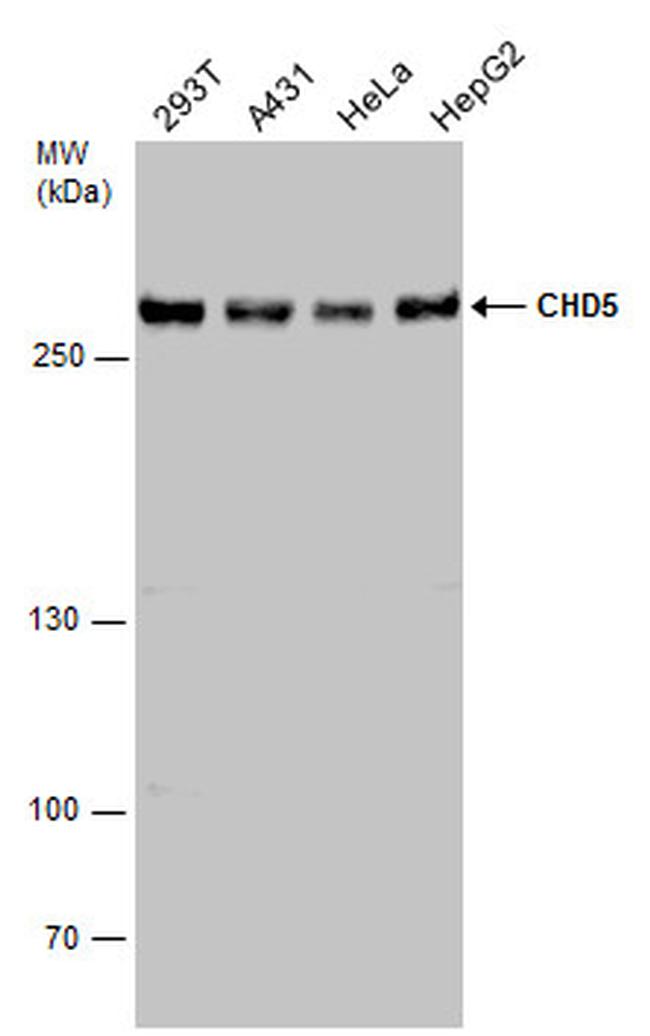 CHD5 Antibody in Western Blot (WB)