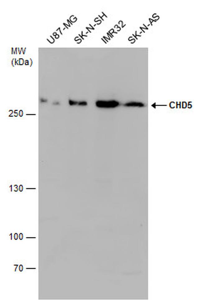 CHD5 Antibody in Western Blot (WB)