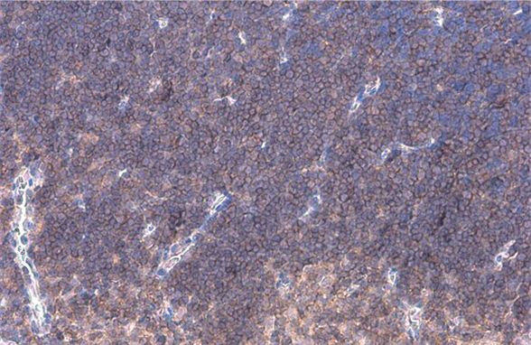 LAT Antibody in Immunohistochemistry (Paraffin) (IHC (P))