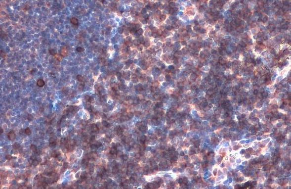 LAT Antibody in Immunohistochemistry (Paraffin) (IHC (P))