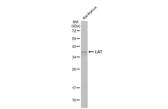 LAT Antibody in Western Blot (WB)