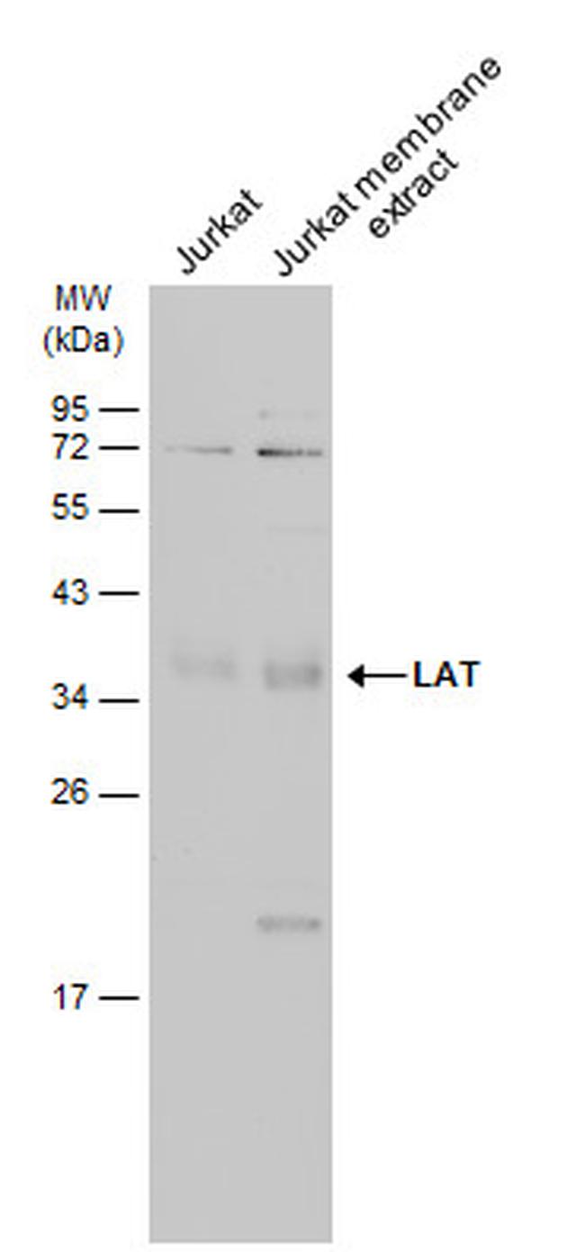 LAT Antibody in Western Blot (WB)