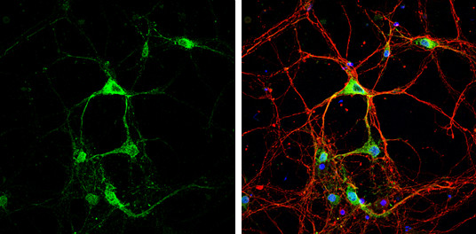 STAU2 Antibody in Immunocytochemistry (ICC/IF)