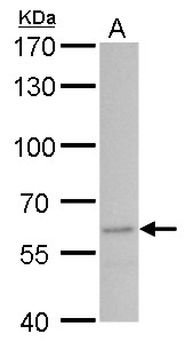 STAU2 Antibody in Western Blot (WB)