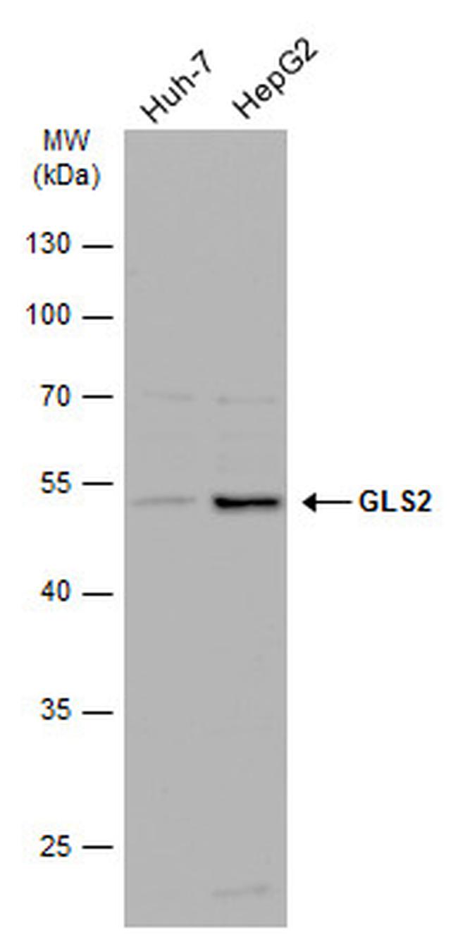 GLS2 Antibody in Western Blot (WB)