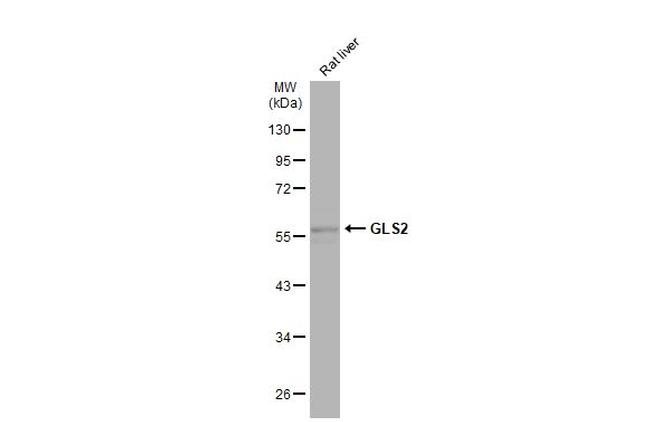 GLS2 Antibody in Western Blot (WB)