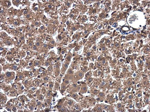 SSU72 Antibody in Immunohistochemistry (Paraffin) (IHC (P))