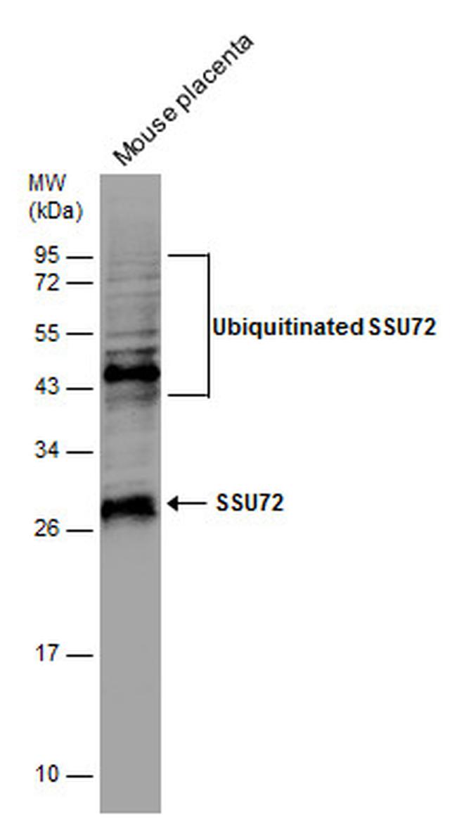 SSU72 Antibody in Western Blot (WB)