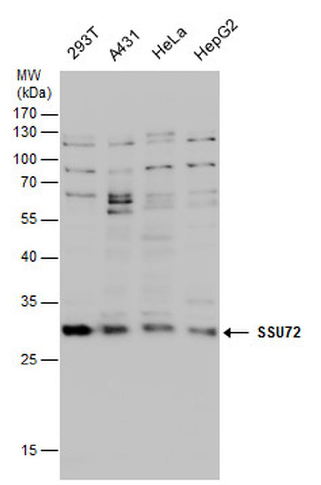 SSU72 Antibody in Western Blot (WB)