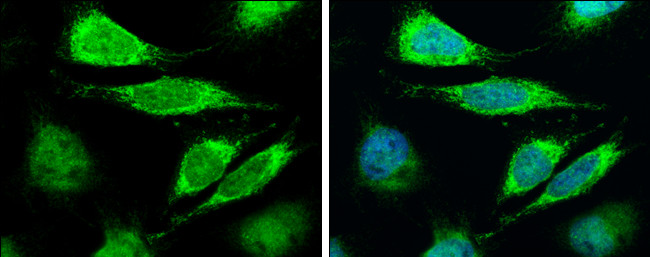 Lass2 Antibody in Immunocytochemistry (ICC/IF)