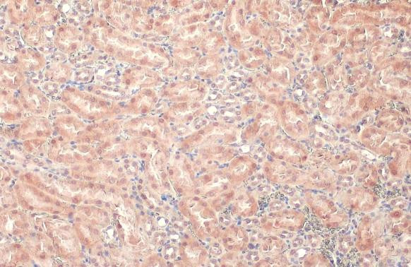 Lass2 Antibody in Immunohistochemistry (Paraffin) (IHC (P))