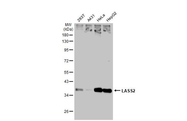 Lass2 Antibody in Western Blot (WB)