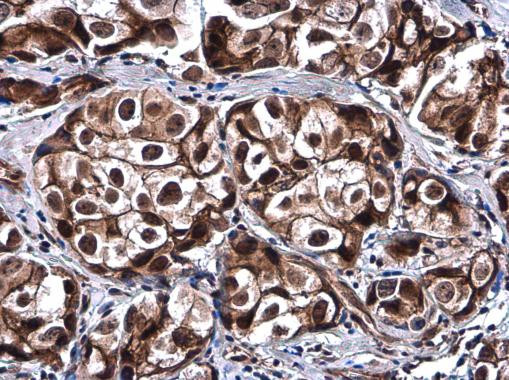 SOX8 Antibody in Immunohistochemistry (Paraffin) (IHC (P))