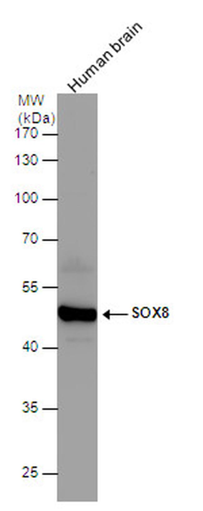 SOX8 Antibody in Western Blot (WB)