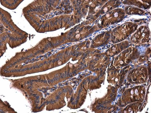 PIK3R4 Antibody in Immunohistochemistry (Paraffin) (IHC (P))