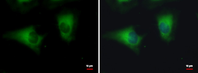 DYNC1LI1 Antibody in Immunocytochemistry (ICC/IF)