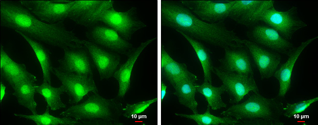 CRBN Antibody in Immunocytochemistry (ICC/IF)