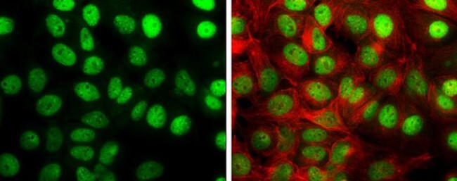 TIF1 gamma Antibody in Immunocytochemistry (ICC/IF)