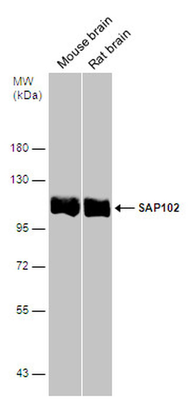 SAP102 Antibody in Western Blot (WB)