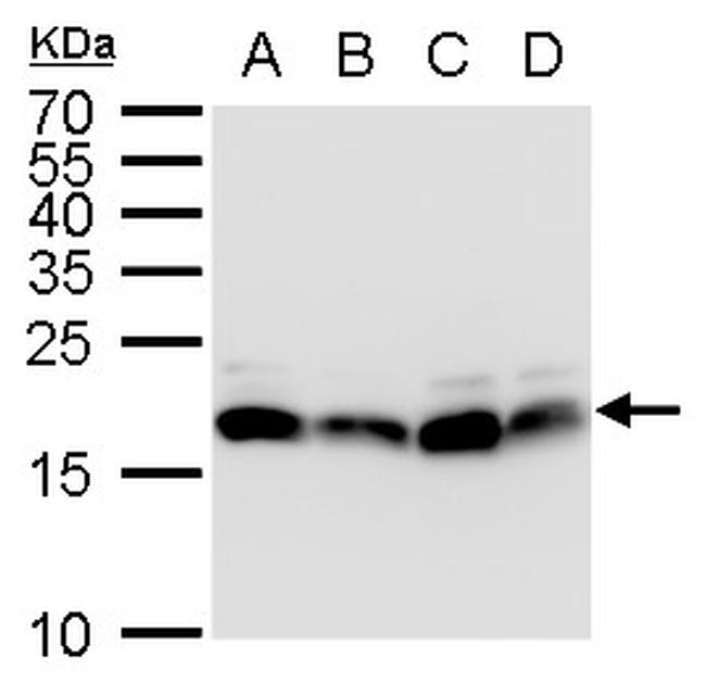 POLE3 Antibody in Western Blot (WB)