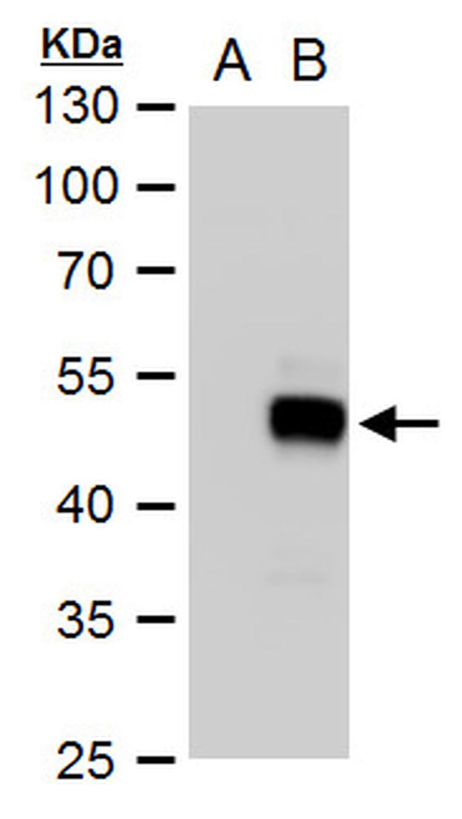 SOX18 Antibody in Western Blot (WB)