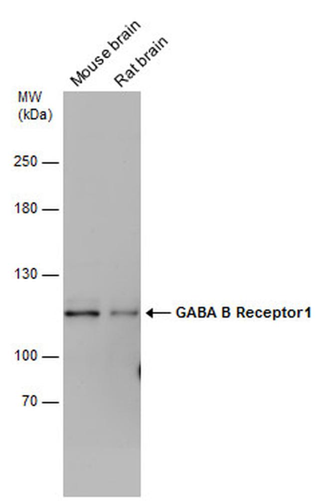 GABBR1 Antibody in Western Blot (WB)