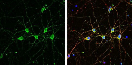 PHD2 Antibody in Immunocytochemistry (ICC/IF)