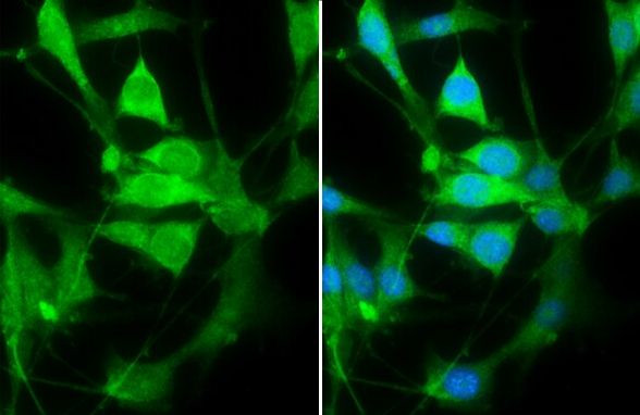 PHD2 Antibody in Immunocytochemistry (ICC/IF)