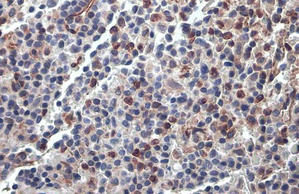 PARP14 Antibody in Immunohistochemistry (Paraffin) (IHC (P))