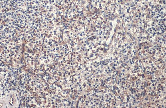 PARP14 Antibody in Immunohistochemistry (Paraffin) (IHC (P))