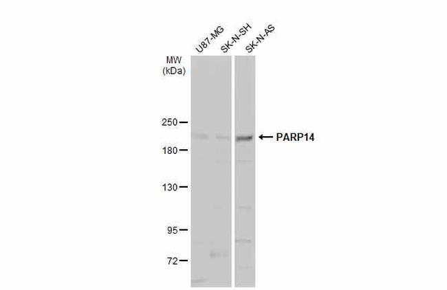 PARP14 Antibody in Western Blot (WB)