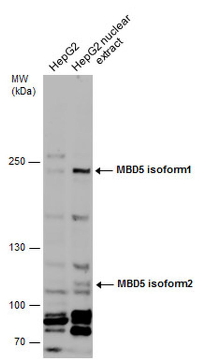 MBD5 Antibody in Western Blot (WB)