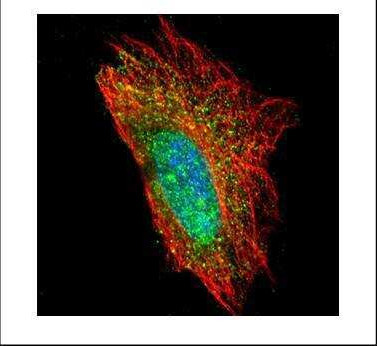 DCP1A Antibody in Immunocytochemistry (ICC/IF)