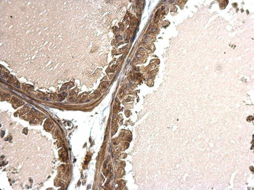 TSG Antibody in Immunohistochemistry (Paraffin) (IHC (P))