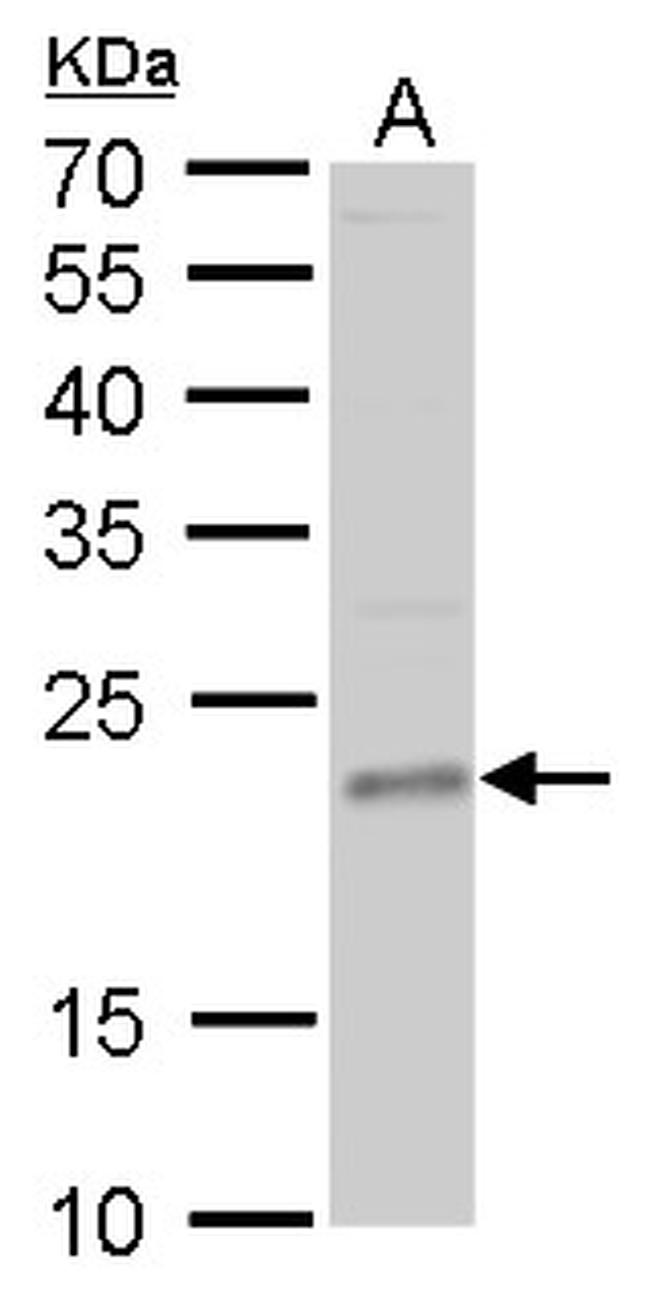 TSG Antibody in Western Blot (WB)