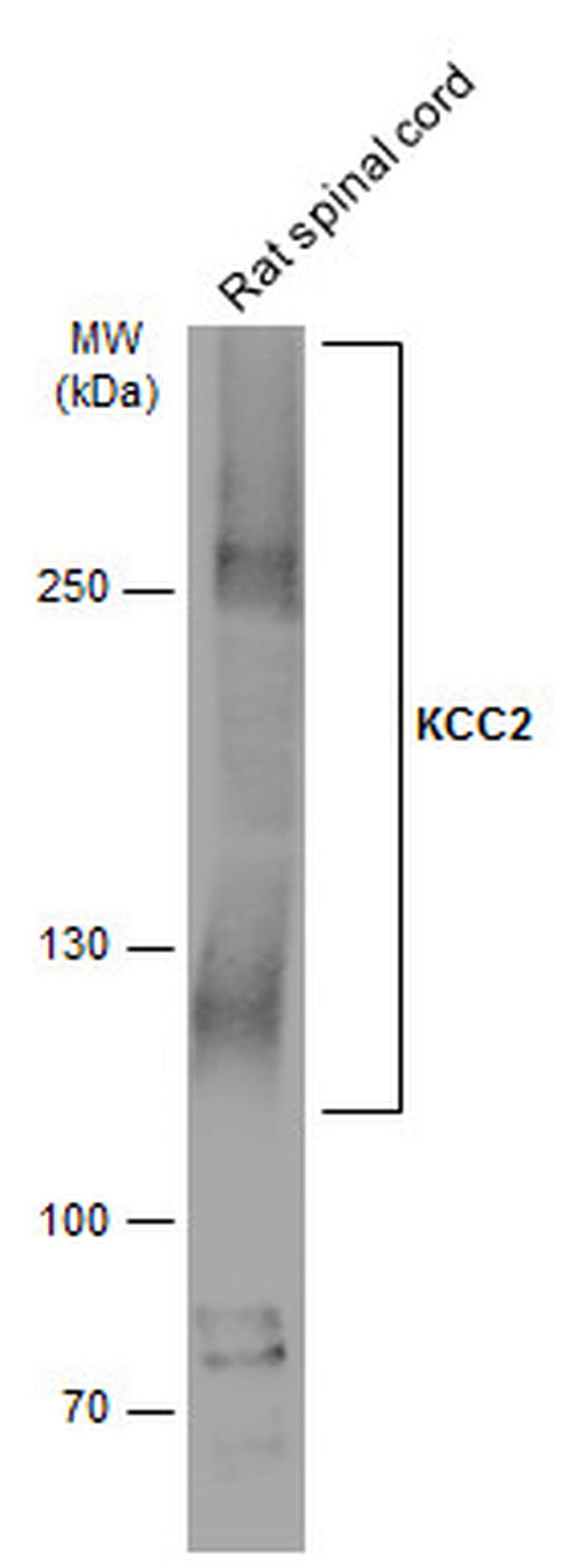 KCC2 Antibody in Western Blot (WB)