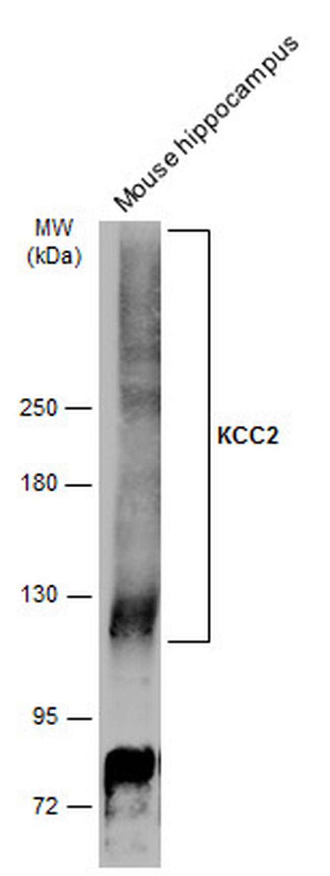 KCC2 Antibody in Western Blot (WB)