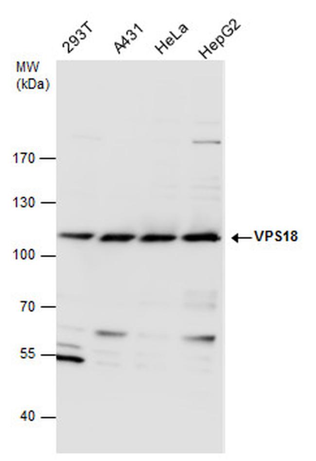 VPS18 Antibody in Western Blot (WB)