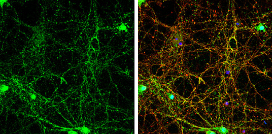 SHANK3 Antibody in Immunocytochemistry (ICC/IF)