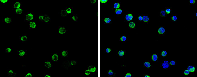 SELK Antibody in Immunocytochemistry (ICC/IF)