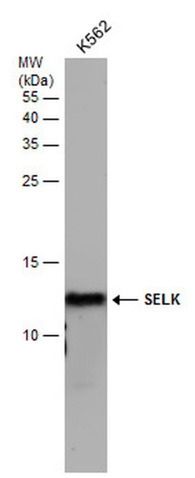 SELK Antibody in Western Blot (WB)